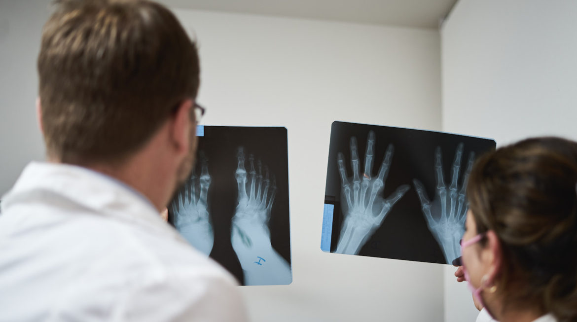 La densitometría ósea y el riesgo real de fractura