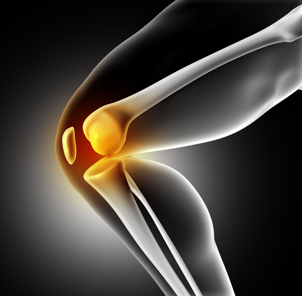 Tratamientos disponibles para la artrosis de rodilla